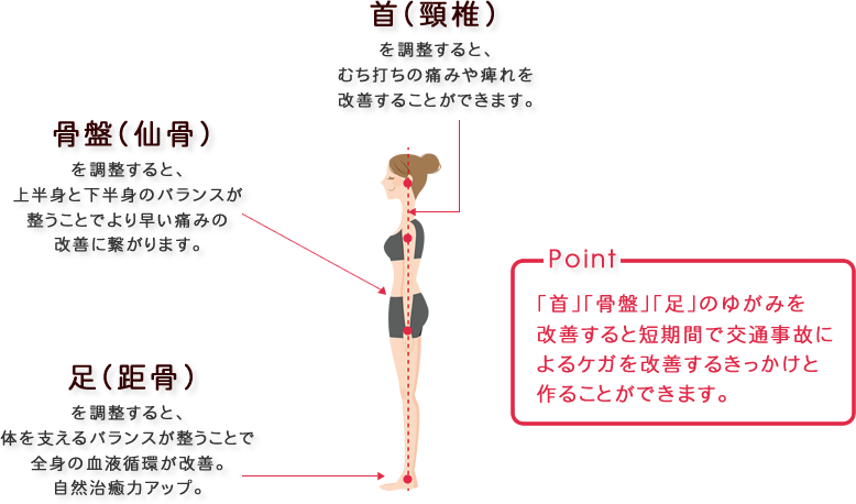 首（頸椎）を調整すると、むち打ちの痛みや痺れを 改善することができます。 骨盤（仙骨）を調整すると、上半身と下半身のバランスが整うことでより早い痛みの改善に繋がります。足（距骨）を調整すると、体を支えるバランスが整うことで全身の血液循環が改善。 自然治癒力アップ。 Point 「首」「骨盤」「足」のゆがみを改善すると短期間で交通事故によるケガを改善するきっかけと作ることができます。